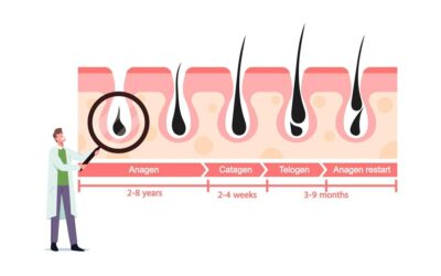 Hair Growth Cycle After Hair Transplant Surgery Month by Month